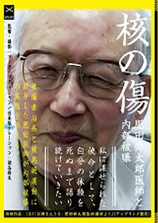 核の傷：肥田舜太郎医師と内部被曝