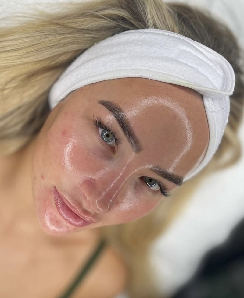 ADN de Salmón en Steticolombiana, estética colombiana en Las Condes