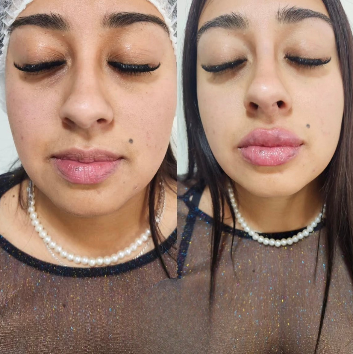 Antes y después de tratamiento en Tempus Clinic