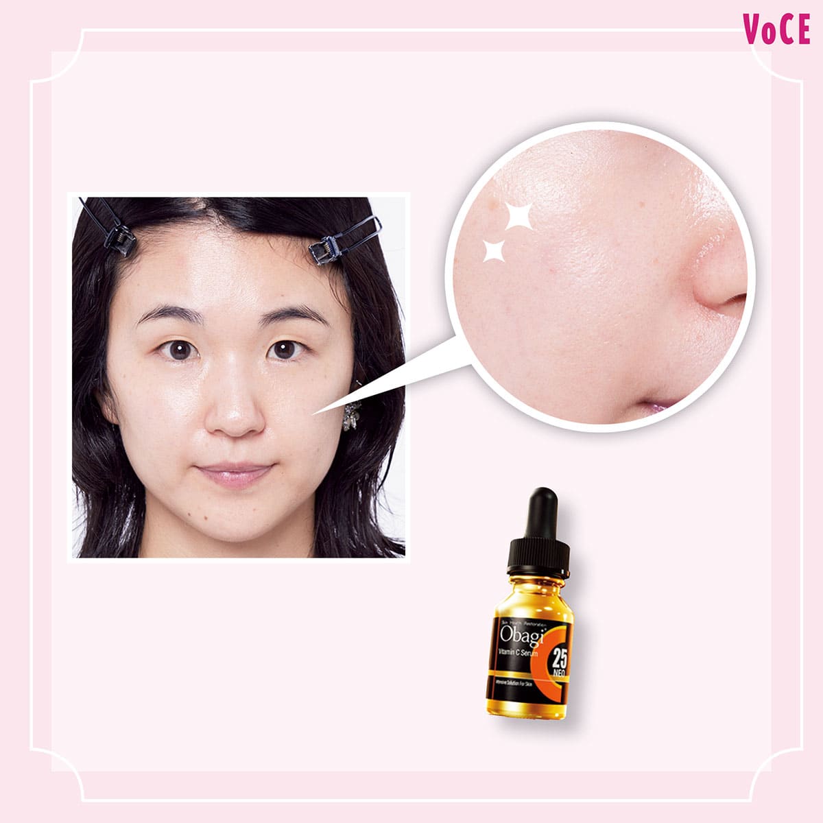 毛穴レス】肌への近道はビタミンC美容液を取り入れるのが正解