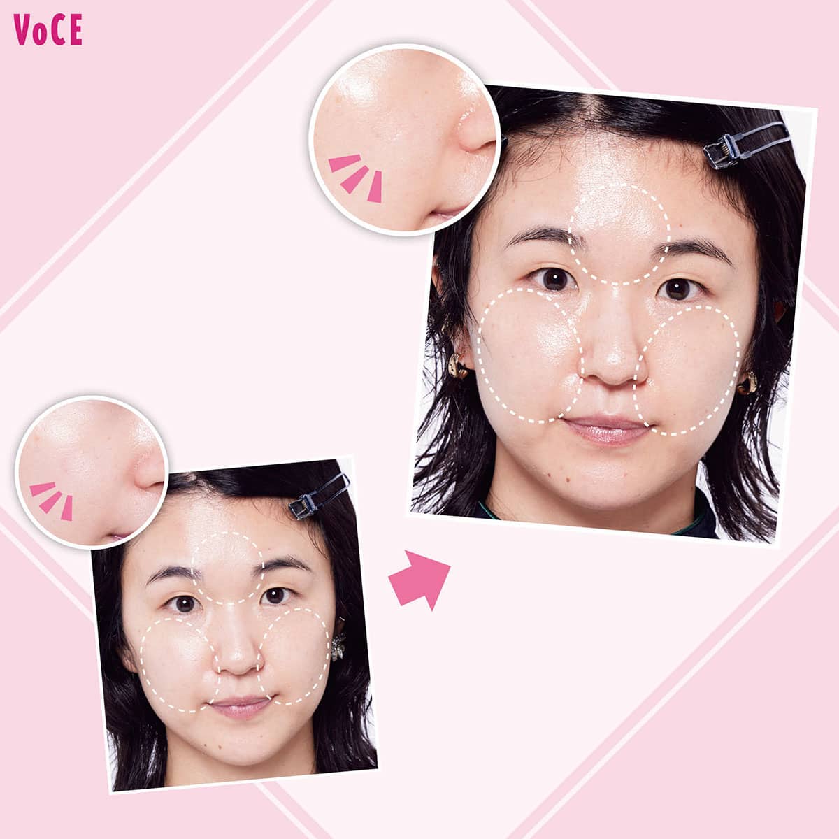 皮脂による【毛穴の開き】が気になるときは油分ケアを見直して！【石井