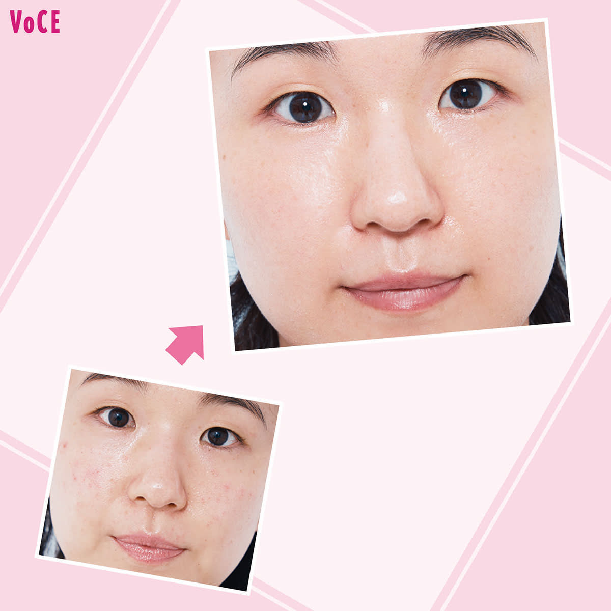 毛穴レス肌】を継続するカギは【皮脂コントロール】にあり！【石井美保