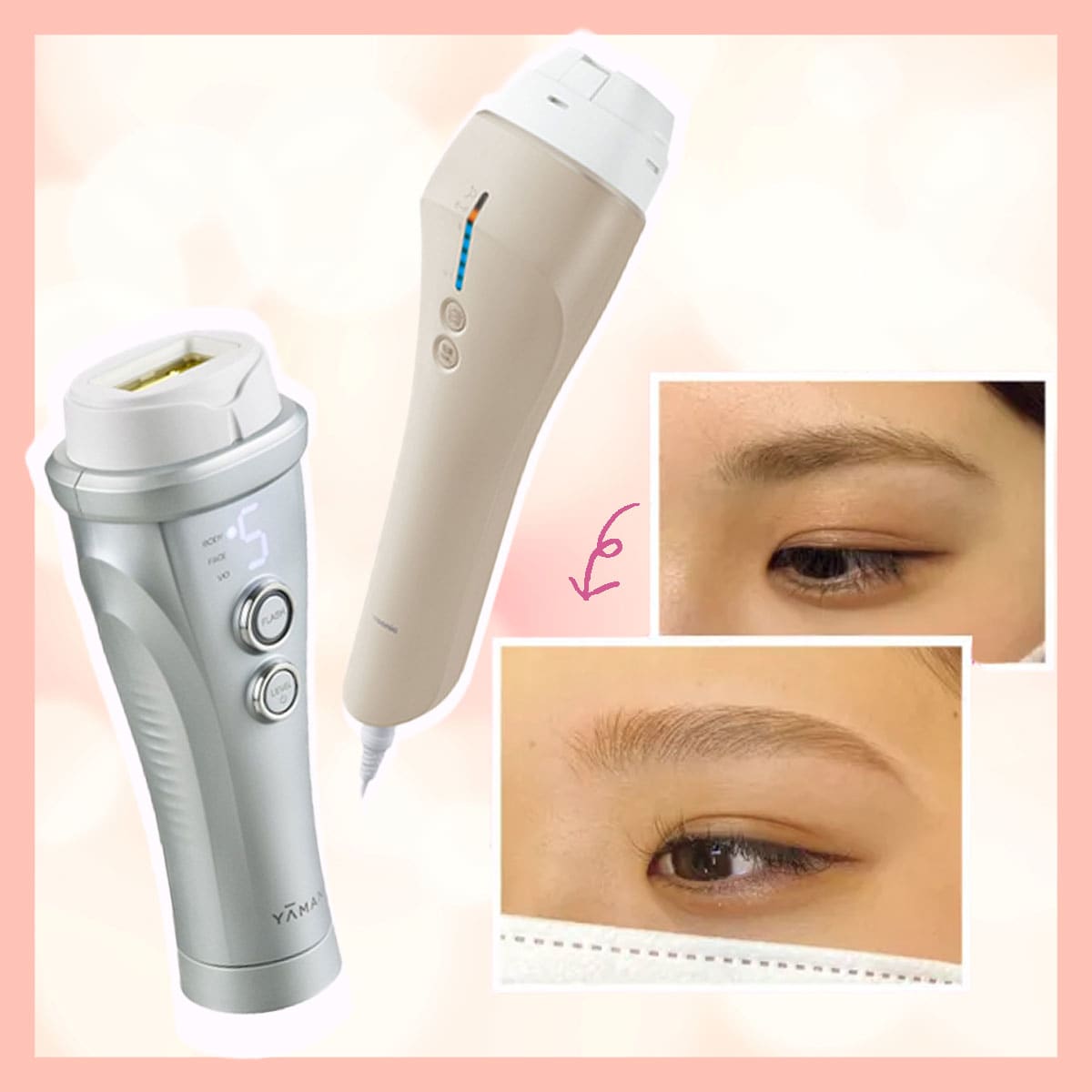 VIO、うなじ、眉脱毛】おすすめサロンから脱毛器まで、知っておくべき 