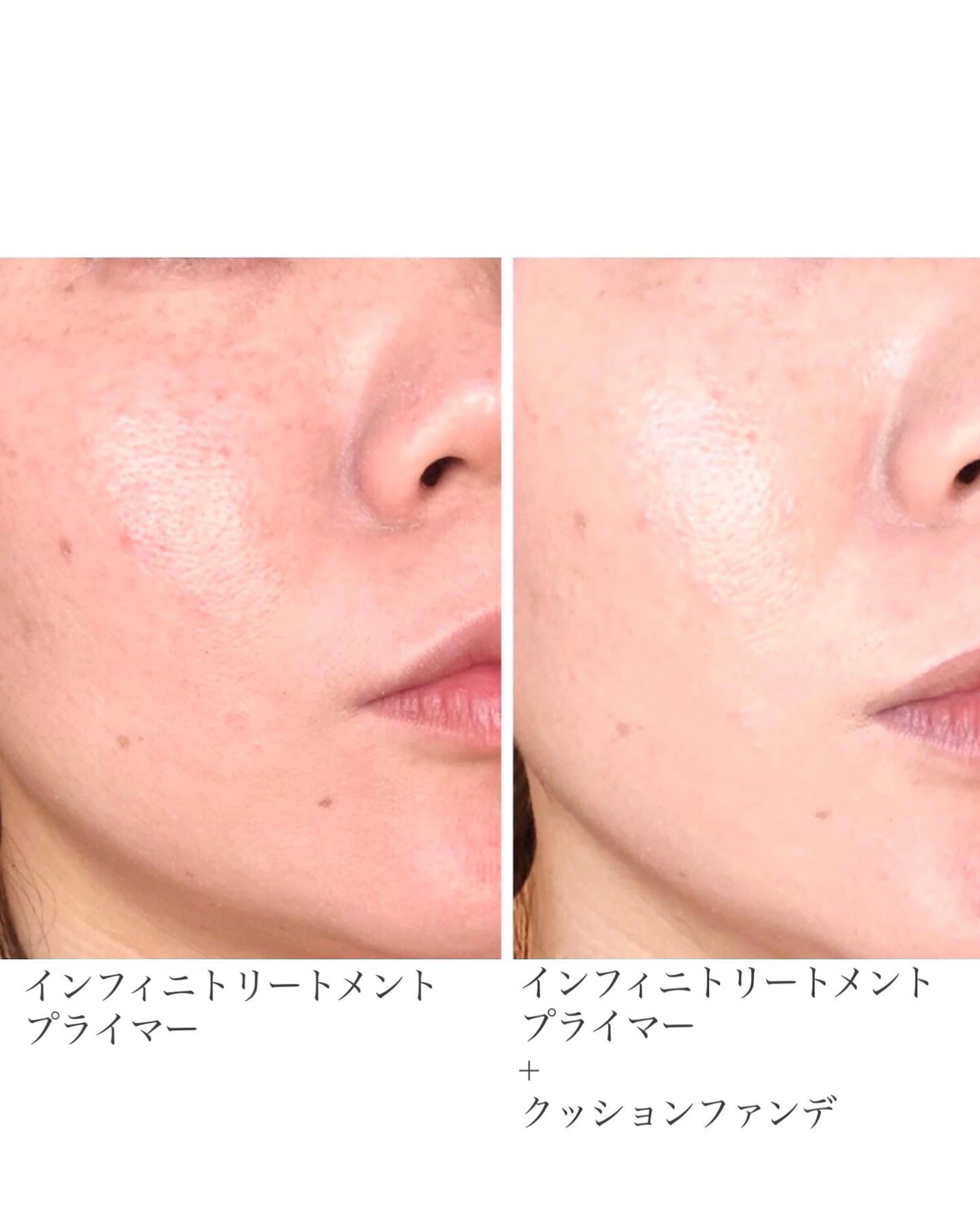 美容好きVOCE会員が使ってみた！SHISEIDO フューチャーソリューション 