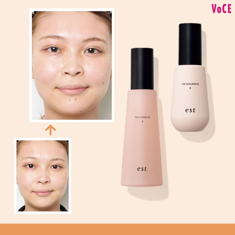 くすみ】を撃退して透明感のある肌を育てるエストの新作化粧水＆乳液