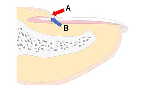 ビューティニュース 甘皮はとってはいけない ネイルケアはプロに頼むのが正解なんです 美容メディアvoce ヴォーチェ ビューティニュース 甘皮はとってはいけない ネイルケアはプロに頼むのが正解なんです 美容メディアvoce ヴォーチェ