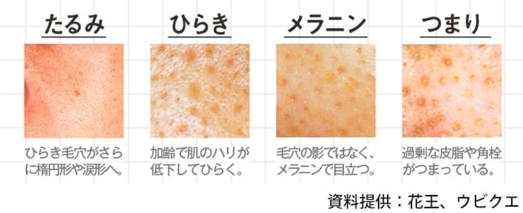 えっ こんなに大きかったっけ アラサーになると毛穴が目立つ理由 ビューティニュース 美容メディアvoce ヴォーチェ えっ こんなに大きかったっけ アラサーになると毛穴が目立つ理由 ビューティニュース 美容メディアvoce ヴォーチェ