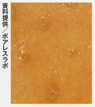 ビューティニュース 毛穴問題 悪化を未然に防ぎ 目指すはつるっと肌 毛穴の目立つ原因 038 ケア方法 美容メディアvoce ヴォーチェ