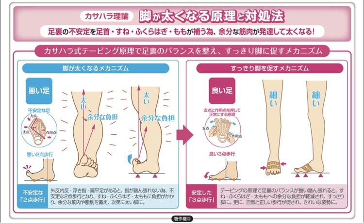 下半身太りの原因はこれだった 3人に1人が浮き指 ビューティニュース 美容メディアvoce ヴォーチェ