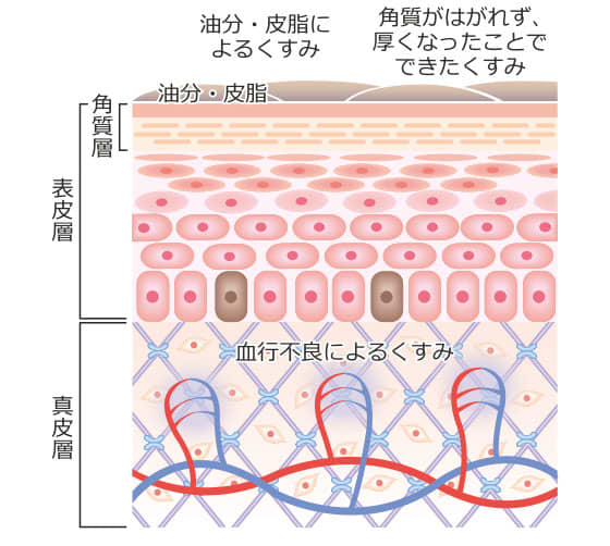 血流が悪いくすみ肌グセ】げっそりコケの超詳細予防と対策【ビューティニュース】｜美容メディアVOCE（ヴォーチェ）