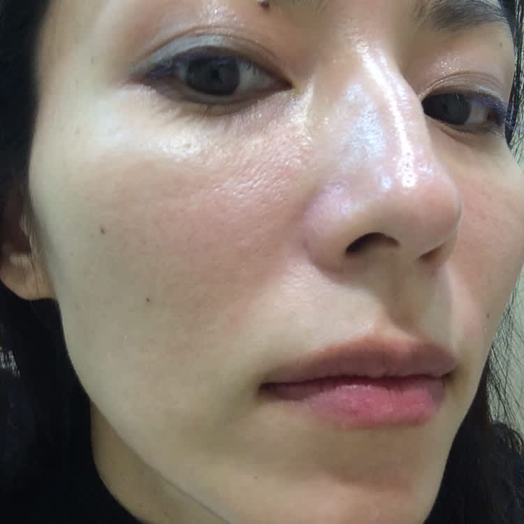 毛穴ケア専門サロン ウビクエ 初体験 長年溜まった毛穴の汚れとさようなら ビューティニュース 美容メディアvoce ヴォーチェ