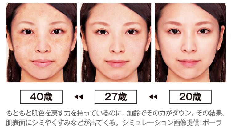 美白シーズン突入 シミ ソバカス 肝斑 ほくろ どれも美白コスメでケアできる ビューティニュース 美容メディアvoce ヴォーチェ 美白シーズン突入 シミ ソバカス 肝斑 ほくろ どれも美白コスメでケアできる ビューティニュース 美容メディアvoce ヴォーチェ