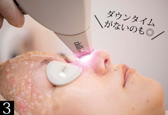 プロの 毛穴ケア 体験レポ たるみ改善 毛穴レス Etc は本当に叶う ビューティニュース 美容メディアvoce ヴォーチェ プロの 毛穴ケア 体験レポ たるみ改善 毛穴レス Etc は本当に叶う ビューティニュース 美容メディアvoce ヴォーチェ
