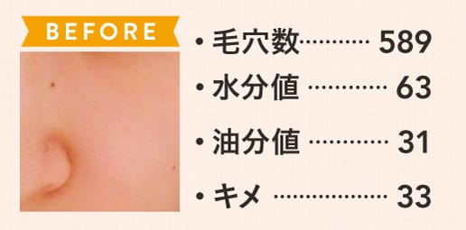 ビューティニュース アラサー人体実験 毛穴対策で毛穴はどれくらい目立たなくなる 美容メディアvoce ヴォーチェ