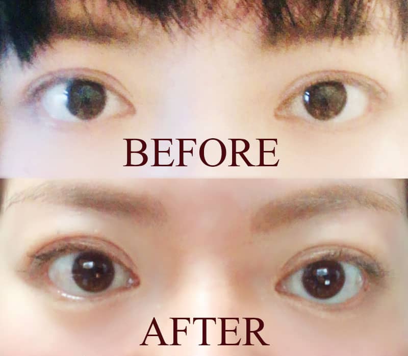 ビューティニュース 整形級の目の大きさ 二重幅の変化に リフトアップ効果大な美容施術 美容メディアvoce ヴォーチェ