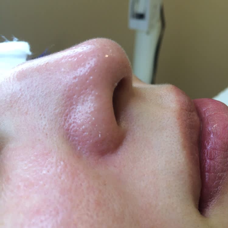 毛穴ケア専門サロン ウビクエ 初体験 長年溜まった毛穴の汚れとさようなら ビューティニュース 美容メディアvoce ヴォーチェ