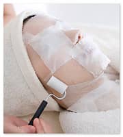 ビューティニュース クリニックを使った毛穴ケア 治療 その種類と方法は 美容メディアvoce ヴォーチェ