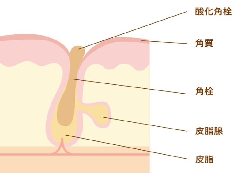 気になる鼻の毛穴の 黒ずみ やってはいけないngケアと効果的な解消法 Vol 18 美容のきほん 美容メディアvoce ヴォーチェ 気になる鼻の毛穴の 黒ずみ やってはいけないngケアと効果的な解消法 Vol 18 美容のきほん 美容メディアvoce ヴォーチェ
