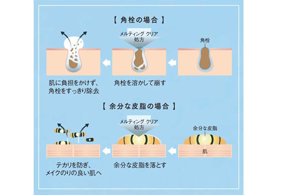 「角栓の場合」「余分な皮脂の場合」