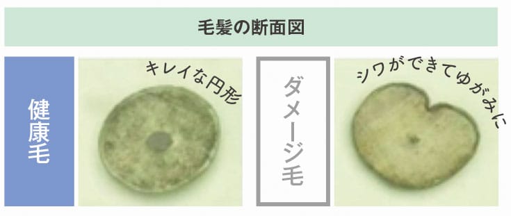 毛髪の断面図