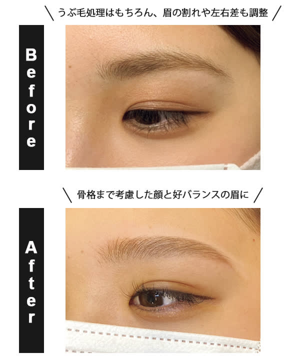 Vio うなじ 眉 最新脱毛ネタ7選 脱毛のおすすめ丸わかり 美容メディアvoce ヴォーチェ Vio うなじ 眉 最新脱毛ネタ7選 脱毛のおすすめ丸わかり 美容メディアvoce ヴォーチェ