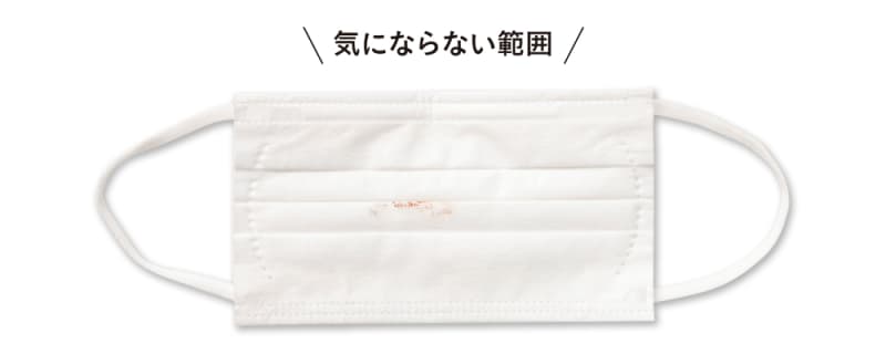 気にならない範囲
