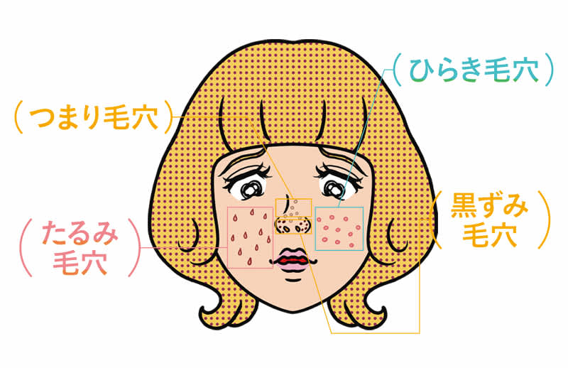 開き つまり 黒ずみ たるみ タイプ別 毛穴ケアまとめ 毛穴ケア最前線 美容メディアvoce ヴォーチェ 開き つまり 黒ずみ たるみ タイプ別 毛穴ケアまとめ 毛穴ケア最前線 美容メディアvoce ヴォーチェ