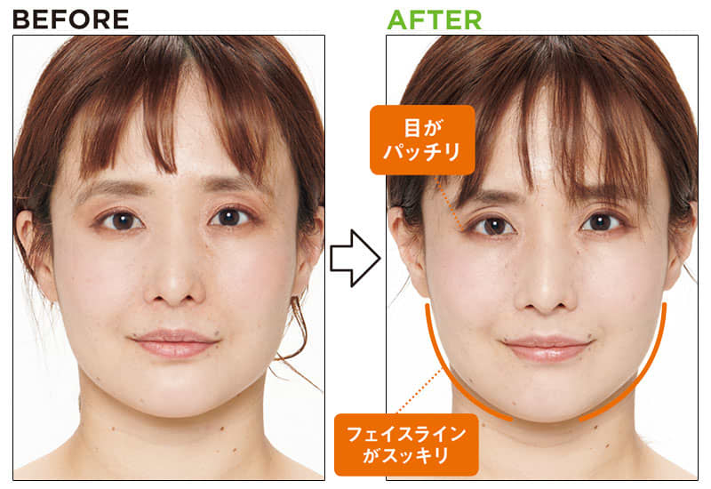 目がパッチリ/フェイスラインがスッキリ