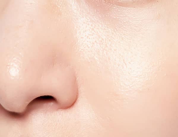 NARS ラディアントクリーミー カラーコレクター使用。ニキビ跡・色ムラは?結果