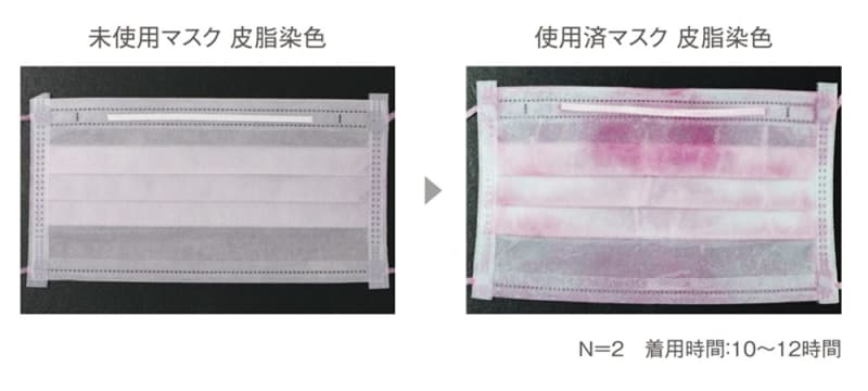 未使用マスク 皮脂染色▶使用済みマスク 皮脂染色/N=2 着用時間:10〜12時間