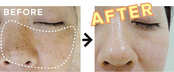 BEFORE・AFTER /フォトRFオーロラ