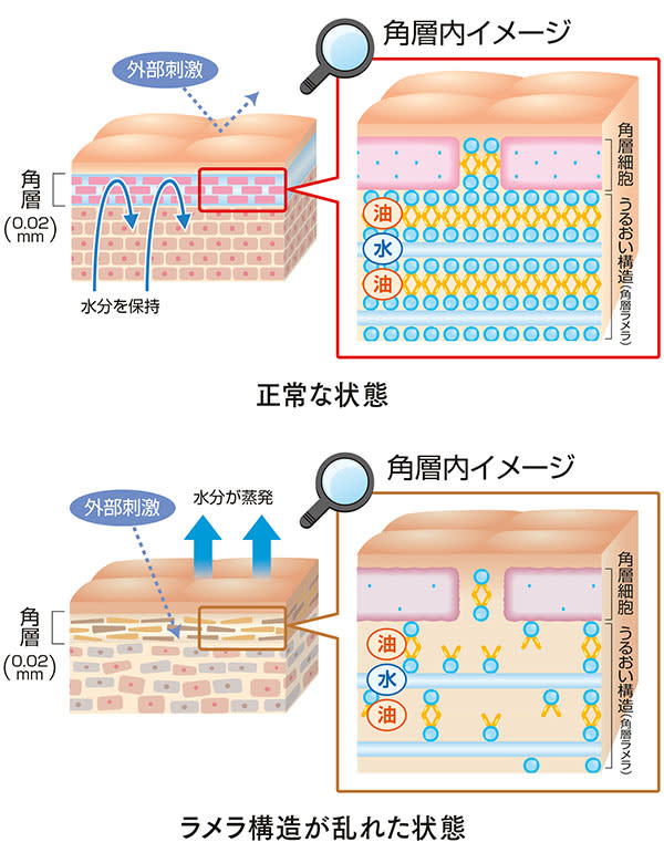 角層内イメージ/正常な状態・ラメラ構造が乱れた状態