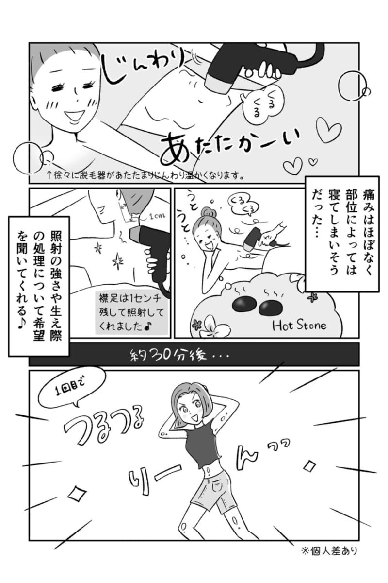 TVなどでお馴染み!アリシアクリニックの医療脱毛って実際どうなの?【2】vol.61