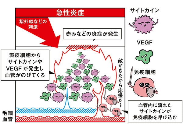 1アイテムで始める 抗炎症ケア コスメ6選 炎症レベルもチェック エイジングが気になる人の 抗炎症ケア 美容メディアvoce ヴォーチェ