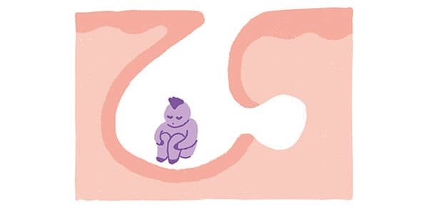 アクネ菌は常に肌に存在