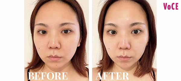 即効性抜群!美容のプロも愛用する【リフトアップ系美顔器】TOP3 即効性抜群!美容のプロも愛用する【リフトアップ系美顔器】TOP3