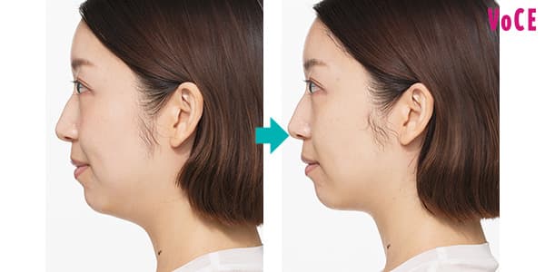 本当に効果のある美顔器おすすめランキング！リフトアップ・たるみ