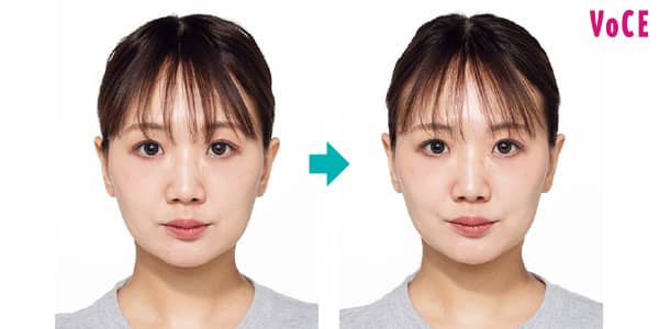 本当に効果のある美顔器おすすめランキング！リフトアップ・たるみ