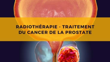 radiotherapie prostate cancer traitement