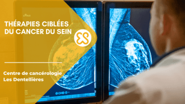 cancer sein therapie ciblee