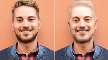 Rides teint taches : deux images du visage d'un homme à des âges différents