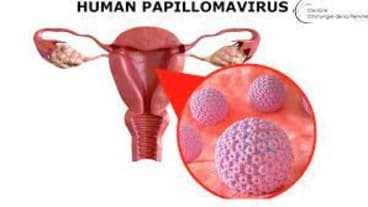 prévention cancer col de l'uterus