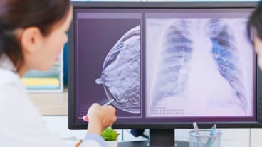 Cancer et traitements innovants : une soignante montre le résultat d'une mammographie à une patiente dans le cadre d'un dépistage du cancer du sein.