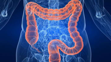 maladies colon