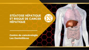 Stéatose hépatique et risque de cancer hépatique