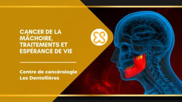 Cancer de la mâchoire - traitements et espérance de vie