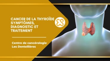 Cancer de la thyroïde – Symptômes, diagnostic et traitement