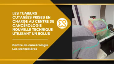 Les tumeurs cutanées - Nouvelles techniques utilisant un bolus