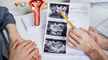 Comment avez-vous découvert votre cancer des ovaires ? Une gynécologue montre des images médicales de ses ovaires à une patiente.