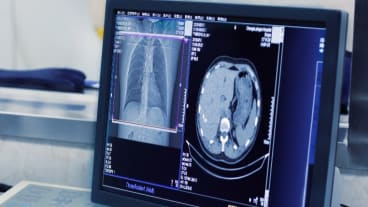 Différence entre radio et scanner ? On voit sur un écran les images obtenues d'un scanner, en plusieurs dimensions.